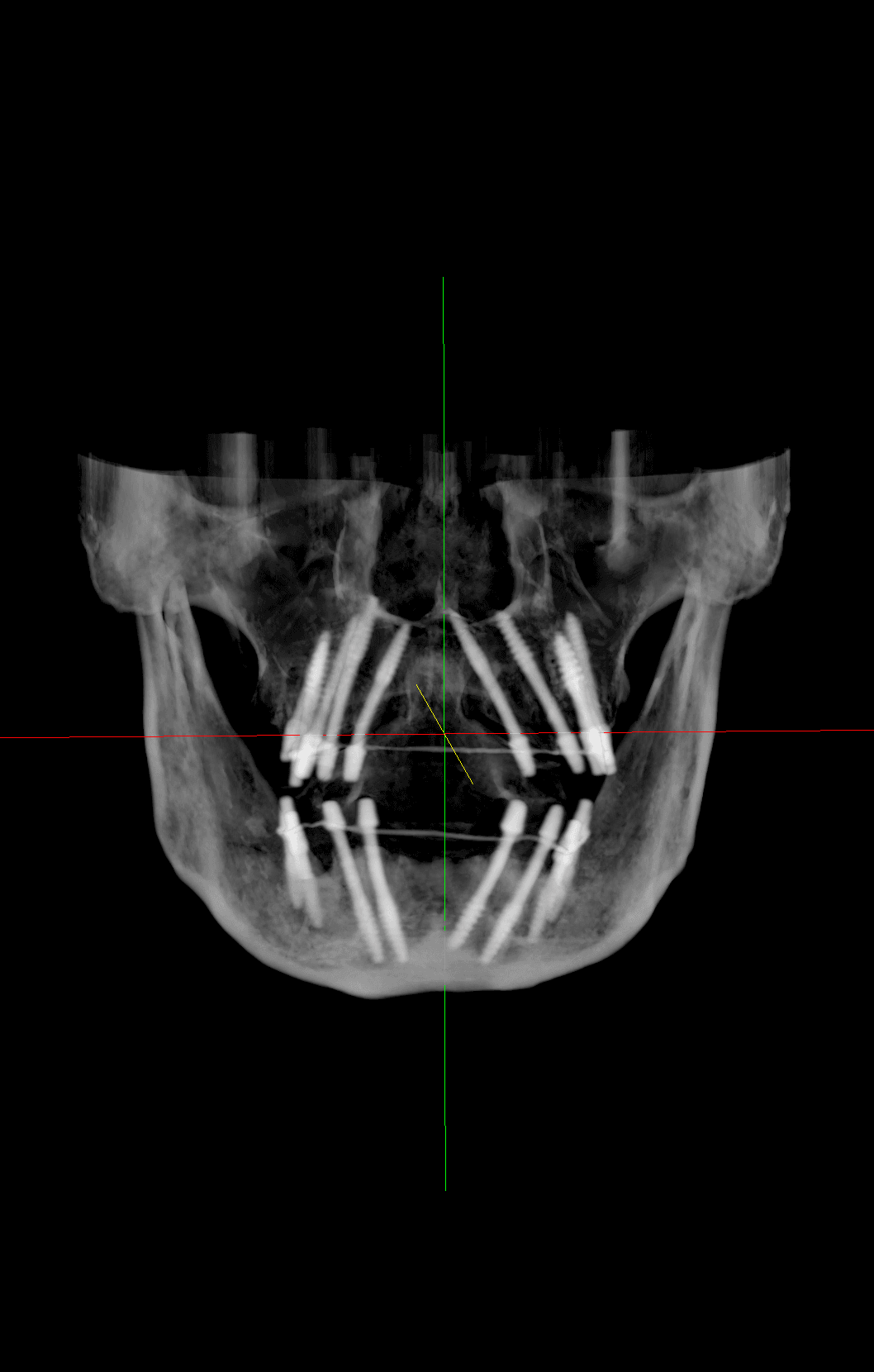 Live Surgery Training